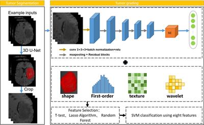 An automated approach for predicting glioma grade and survival of LGG patients using CNN and radiomics